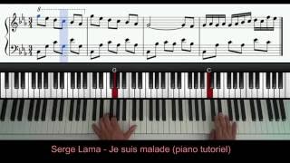 Serge Lama  je suis malade piano tutoriel [upl. by Kerekes693]