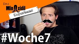 Um ein Haar zuviel Nebenwirkung  Das Minoxidil Experiment Woche7 [upl. by Fiedler]