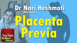 placenta previa treatment  low lying placenta in pregnancy  mommy expertise [upl. by Garate]