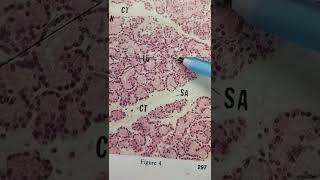 Lacrimal Gland Histology Quick Overview [upl. by Eannej]