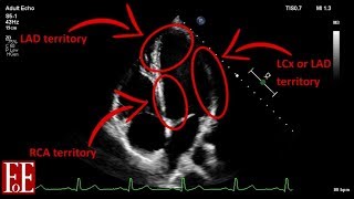 Foundations of Echocardiography BSE Level 1 Focused Scan [upl. by Gibeon]