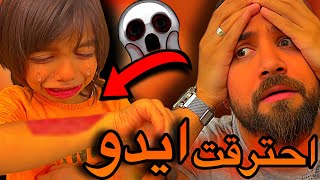 احترقت ايدو 😱😭ياريت ماصورنا هالفيديو😩💔 [upl. by Haridan640]