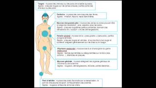 Traitements Naturel Des Mycoses [upl. by Miranda]