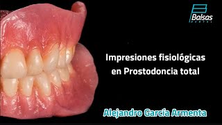 Impresiones Fisiológicas en Prostodoncia Total Alejandro García Armenta [upl. by Kimmel403]