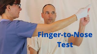 FingertoNose Test [upl. by Walton]