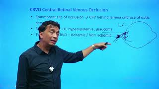 Ophthalmology  Rapid Revision  Part 3  Target FMGE 2024  Dr Saswat Ray720PHD [upl. by Nations]