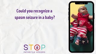 Could you recognize a spasm seizure in a baby [upl. by Morten]