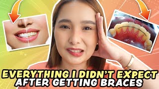 Braces Update  Why I Changed My Retainers [upl. by Prent]