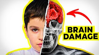 How Real is Brain Damage in Kids MMA CTE [upl. by Eet]