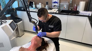 Ablative Erbium Laser for Skin Resurfacing  West Hollywood CA  Dr Jason Emer [upl. by Aicnelev]