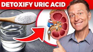 The Ultimate Kidney Cleanse for Uric Acid and Gout Dr Bergs Proven Techniques [upl. by Hibbs]