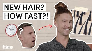 How Fast Does Minoxidil Work A Doctor Explains Minoxidil Results [upl. by Ellehsad]