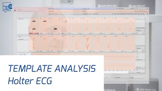 Holter ECG with custo diagnosticPart 3 template analysis [upl. by Aikehs]