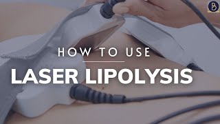 How to use Laser Lipolysis bodysculpting [upl. by Honebein266]