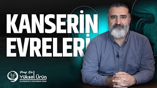 Kanserin evreleri nelerdir   ProfDr Yüksel Ürün [upl. by Pliam]