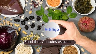 How to increase Melanin for Vitiligo l Vitiligo Food that Contains Melanin My Skin [upl. by Yank]