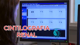 Cintilografia Renal em Crianças [upl. by Assilaj171]