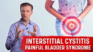 What is Interstitial Cystitis Painful Bladder Syndrome – Symptoms amp Remedy Covered by DrBerg [upl. by Lasser871]