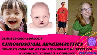 CHROMOSOMAL ABNORMALITIES CLASS 12BIOZOOLOGYIN TAMILBIOCLENCH [upl. by Ainslie]