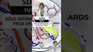 Comprendre et Prévenir le SDRA  Guide pour les Infirmiers ide tutorial nurse ards covid19 [upl. by Georgi88]