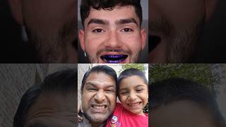 🥶🍭❌shorts toothbrush dentist satisfying teethwhitening braces teeth dentaldigest youtube [upl. by Nunes761]