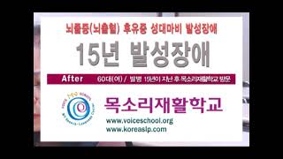 뇌졸중 발병 15년후 방문 뇌혈관질환 후유증 성대마비 발성장애 음성치료 음성떨림 음도불안 발성치료 voice disorder 음성재활 후기 voiceschool 목소리재활학교 [upl. by Marijo20]