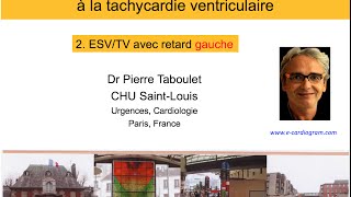 10b De lESV à la tachycardie ventriculaire Retard gauche P Taboulet [upl. by Yenahc]