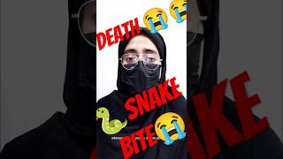 Snake🐍bite youtubecreators 5MinuteCraftsYouTube yrf LOLBrainRot LittleBabyBum HUMTV [upl. by Ydennek]