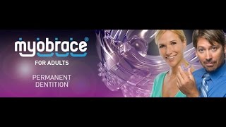 Myobrace for adults [upl. by Nalyd]