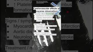 Cardiovascular effects of cocaine intoxication [upl. by Echikson]