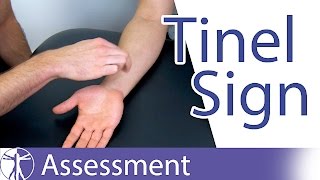 Tinel Sign Wrist  Carpal Tunnel Syndrome Diagnosis [upl. by Hummel]