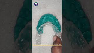 Toothsi  Dentist Lab World  Orthodontics Teeth Treatment  Painless  Tamil Dental Lab🦷dentallab [upl. by Oisinoid]