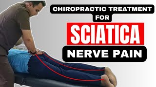 Transform Your Life Say Goodbye to Sciatica Pain [upl. by Atsirhc976]