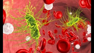 GENERAL PATHOLOGY 22  bacteraemia  toxaemia  septicaemia amp pyaemia DR SAMEH GHAZY [upl. by Akimed]