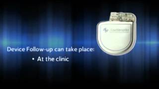 What is an Implantable Cardioverter Defibrillator ICD [upl. by Evetta]