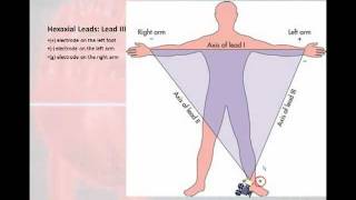 12 Lead Interpretation Part 1 Introduction to the 12 Lead EKG [upl. by Anauqahs883]