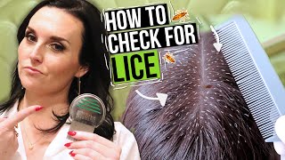 How to Check for Lice  5 Lice Treatment Tips from a Professional [upl. by Aikmat]