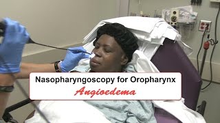 Emergency Nasopharyngoscopy for Angioedema Evaluation [upl. by Web326]