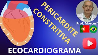 Desafiando a pericardite constritiva passo a passo para um diagnóstico definitivo [upl. by Oam]