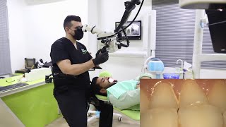 Dental Microscope  How To Increase Efficiency And Patient Satisfaction [upl. by Annawad206]