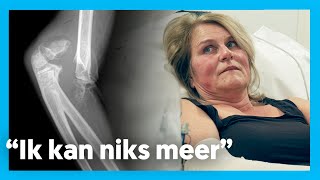 BEIDE ELLEBOGEN GEBROKEN  Op de spoed [upl. by Nat113]