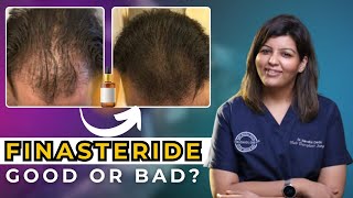 Hair loss मैं FINASTERIDE कितना जरूरी है  Right Age to Start Finasteride  Dr Nandini Dadu [upl. by Lamoree]