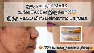 face black mark remove cream best result tamil [upl. by Aslin]