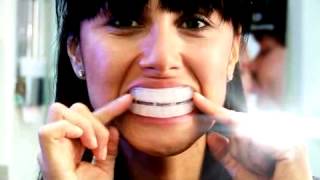 Instructions for home teeth whitening kit [upl. by Intyre]