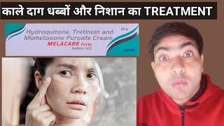 melacare forte cream use in hindi  melacare forte cream review [upl. by Lashonda]