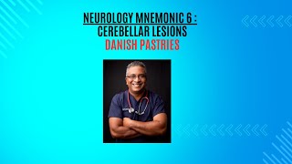 Neurology Mnemonic 6  Cerebellar lesions [upl. by Adla]