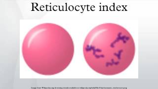 Reticulocyte index YouTube [upl. by Tiffi]