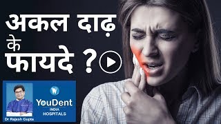 जानते हो अकल दाढ़ किस काम आती है  Dental Care  V 04  YouDent India Hospitals [upl. by Artema]