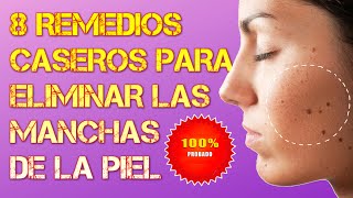 8 Remedios Caseros Para Eliminar Las Manchas De La Piel [upl. by Alyaj]