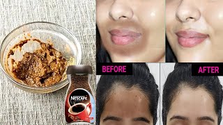 Coffee से स्किन का कालापन हटाए Remove Black Skin Around Mouth amp Forehead Upper Lips Skin Whitening [upl. by Eisenberg]